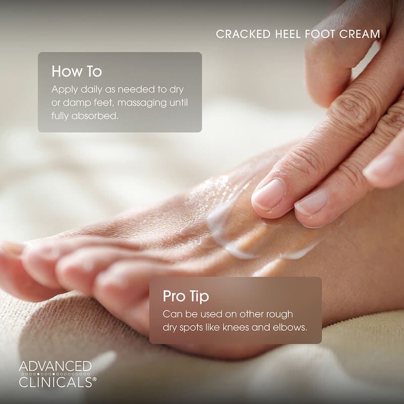 Advanced Clinicals, Cracked Heel, Rough Spot Cream, 8 fl oz (237 ml)