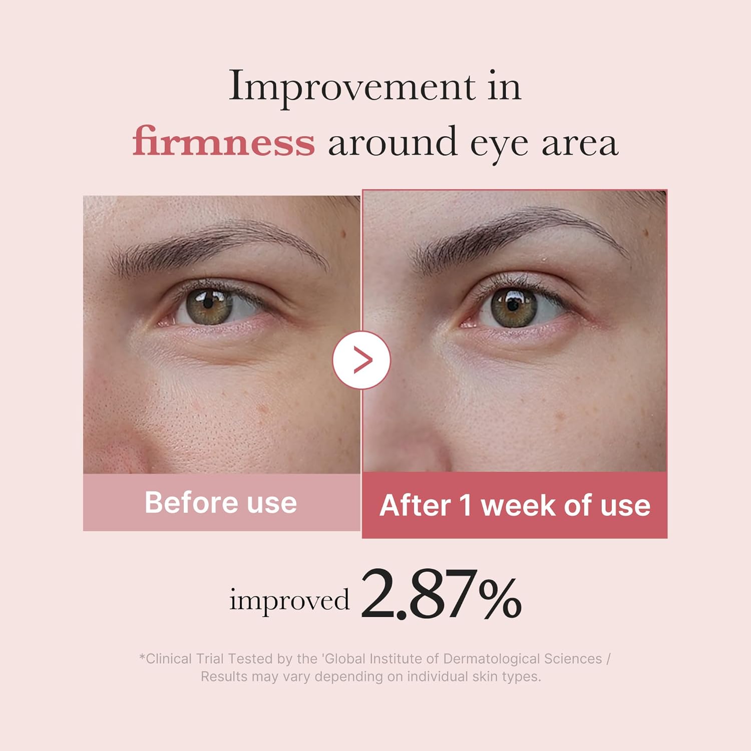 medicube - Eye Serum with Salmon DNA PDRN & Pink Peptides