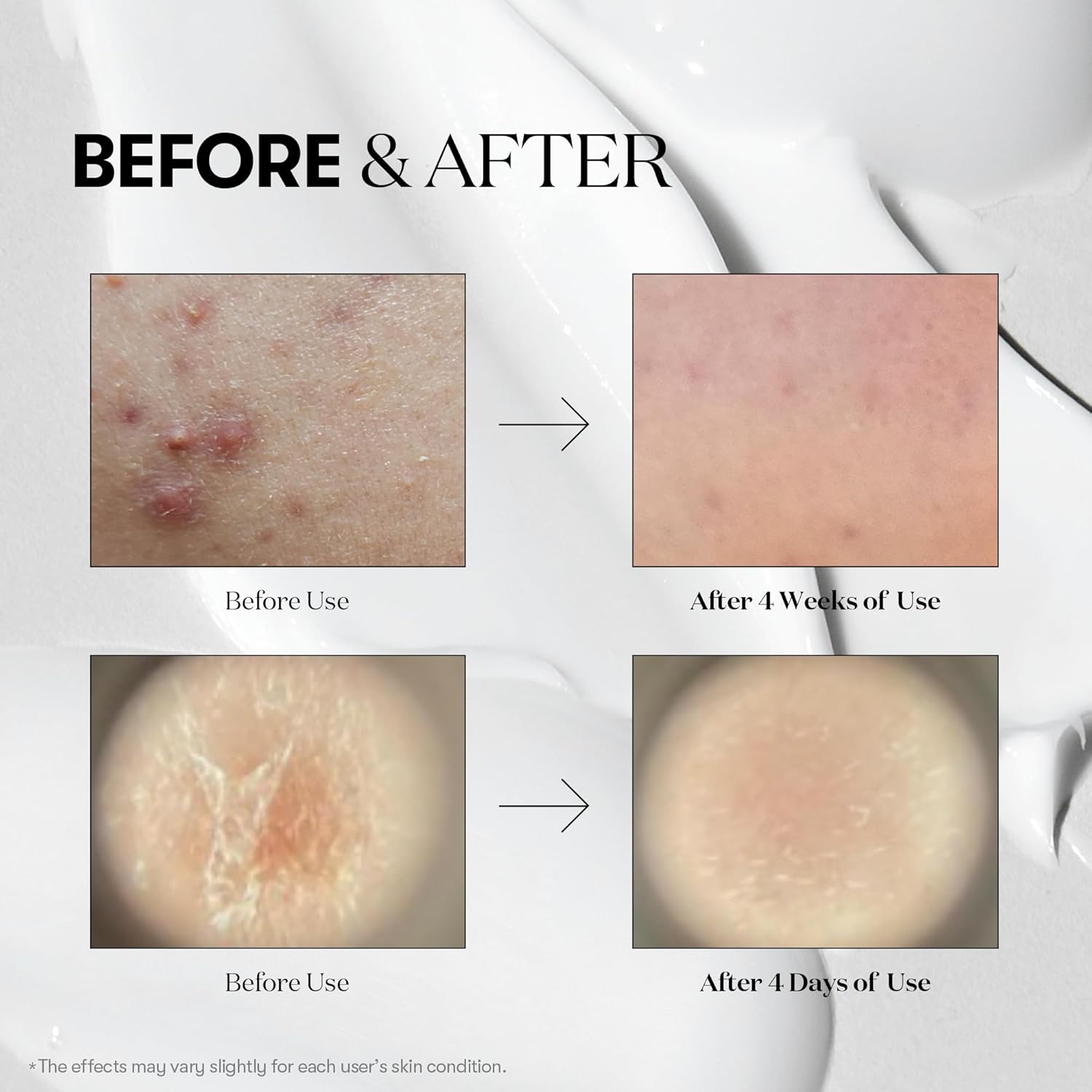 VT COSMETICS - CICA Reedle Shot 100