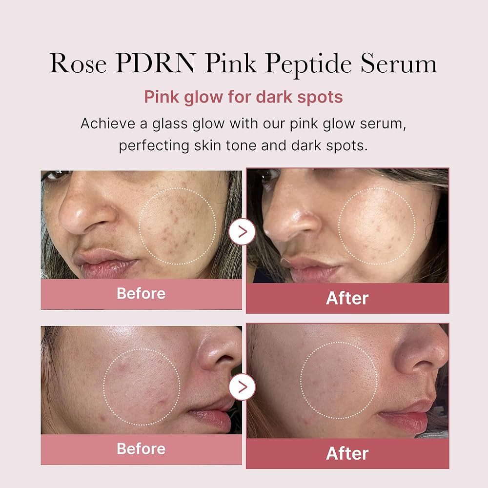 MEDICUBE - PDRN Pink Peptide Serum