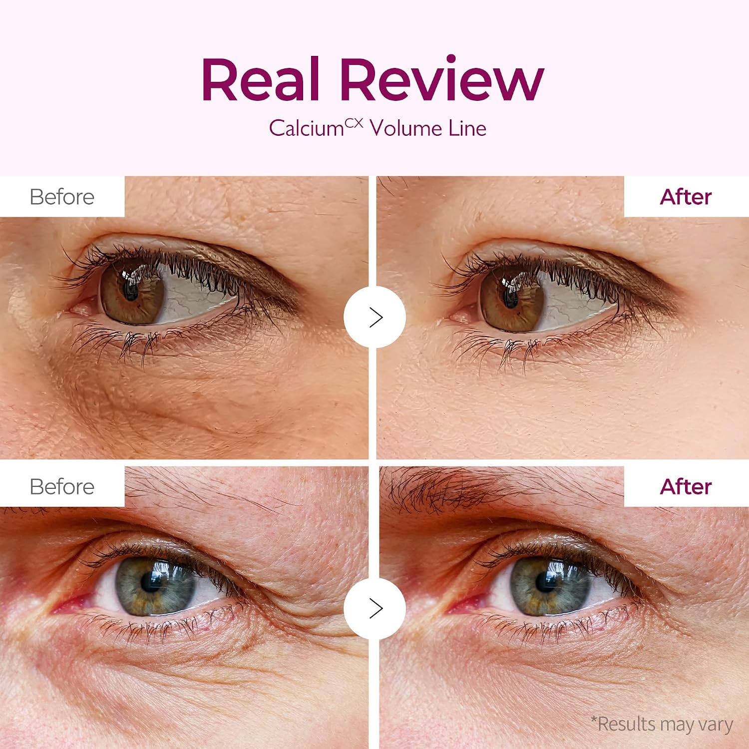 Dr.Melaxin - Calcium Volume Under Eye Patches