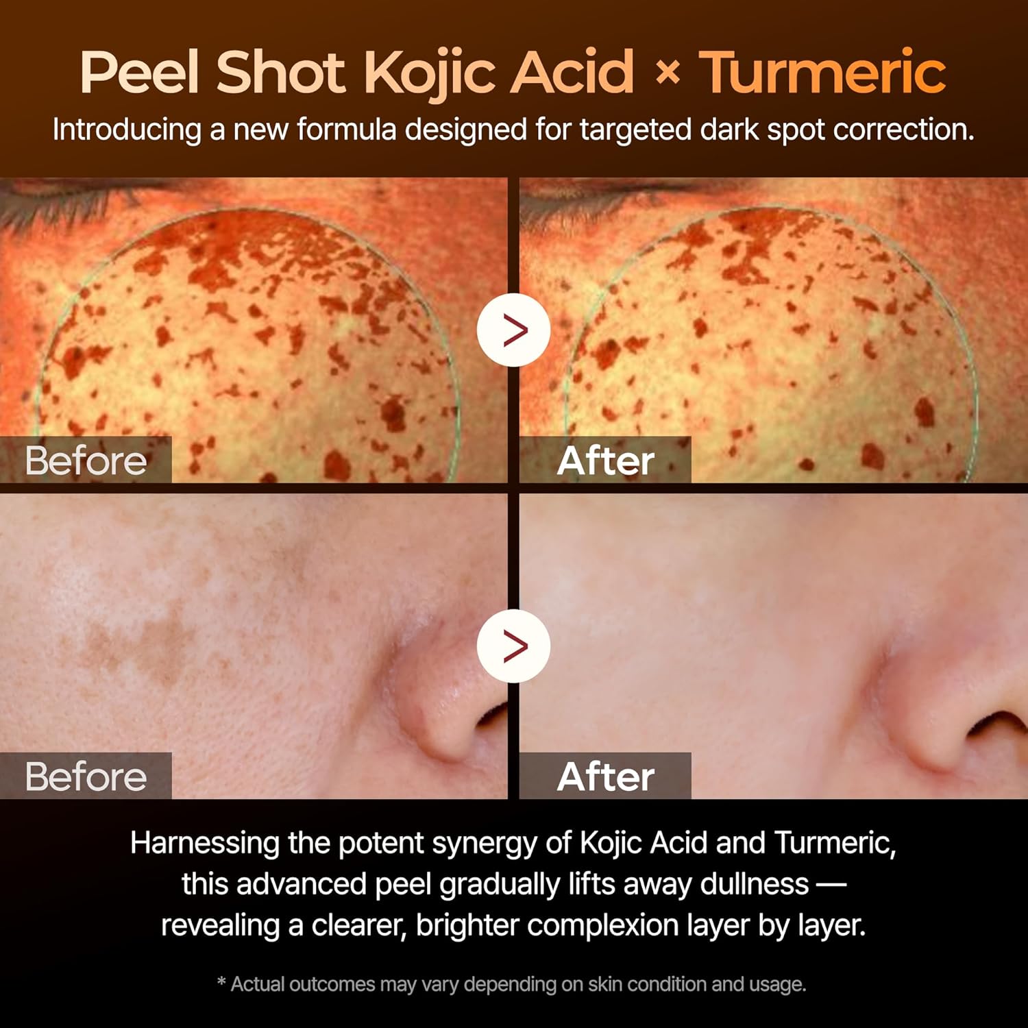 Dr. Melaxin - Peel Shot Kojic Acid Turmeric Serum