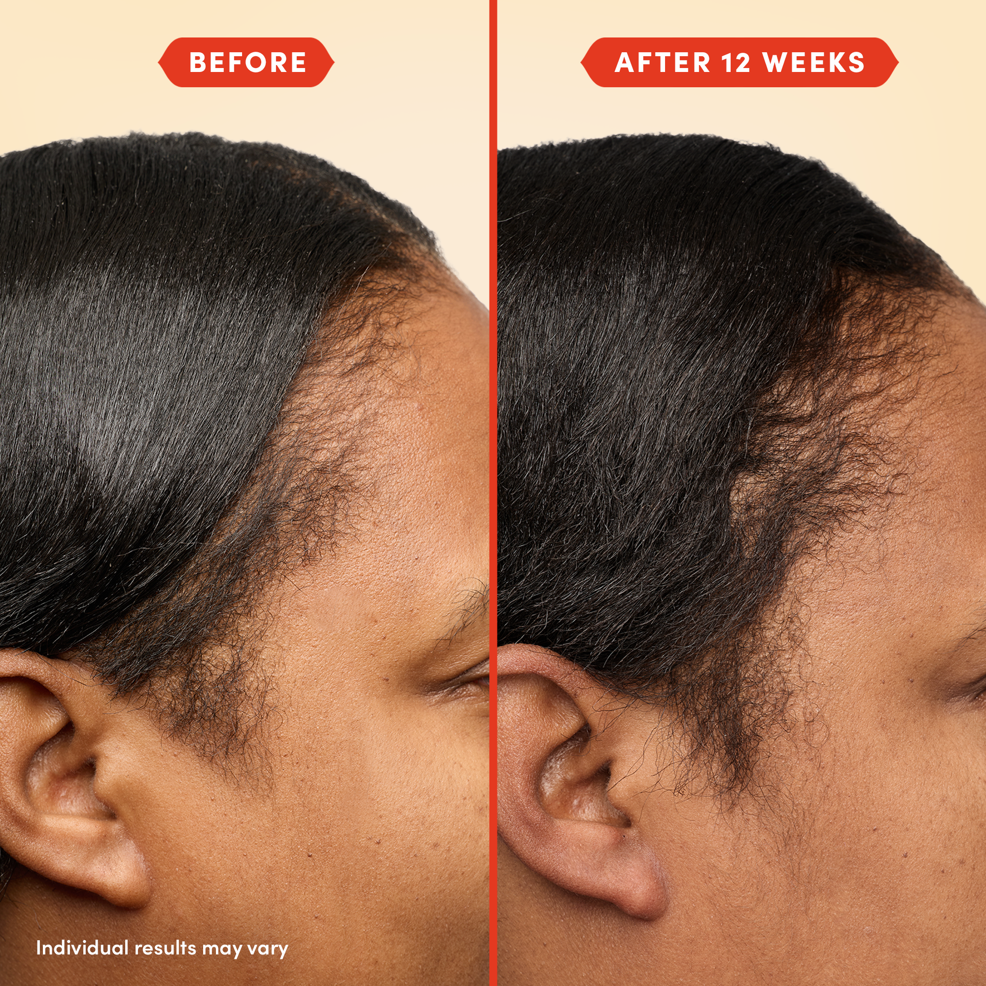 fable and mne - HoliRoots™ Hair Oil