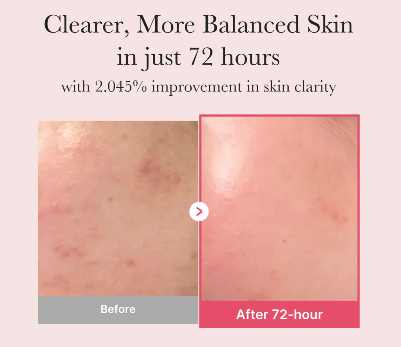 MEDICUBE - TXA Niacinamide Serum