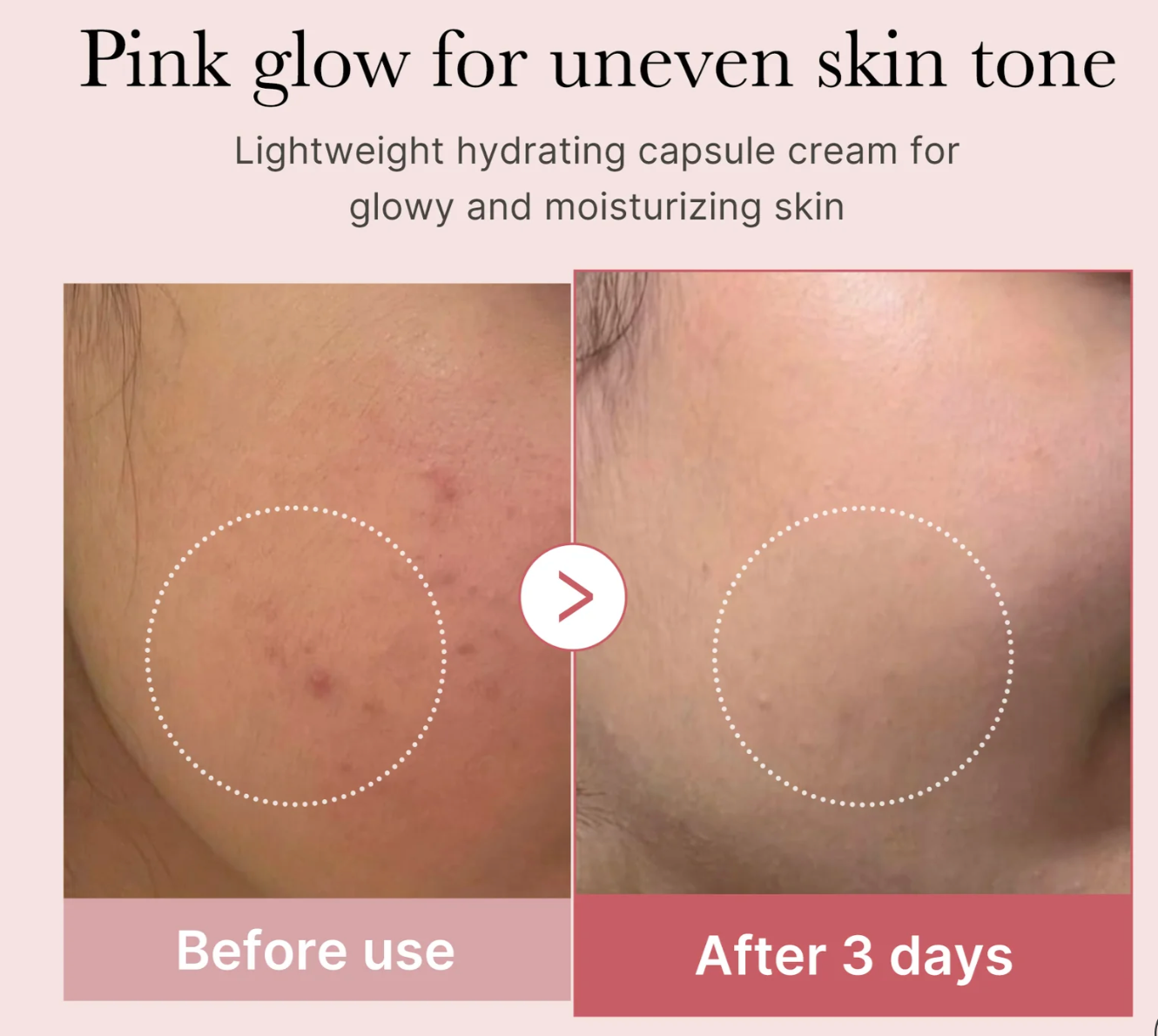 MEDICUBE - PDRN Pink Collagen Capsule Cream