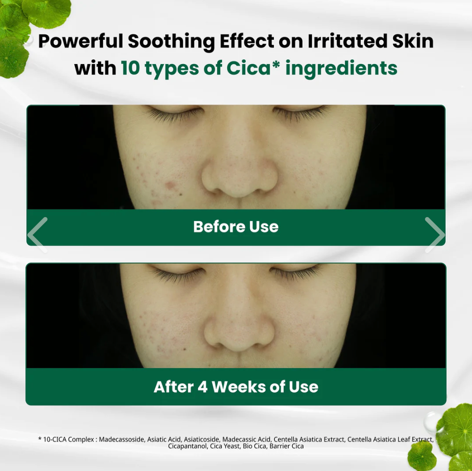 DR.G - R.E.D BLEMISH CLEAR SOOTHING CREAM (70ML)