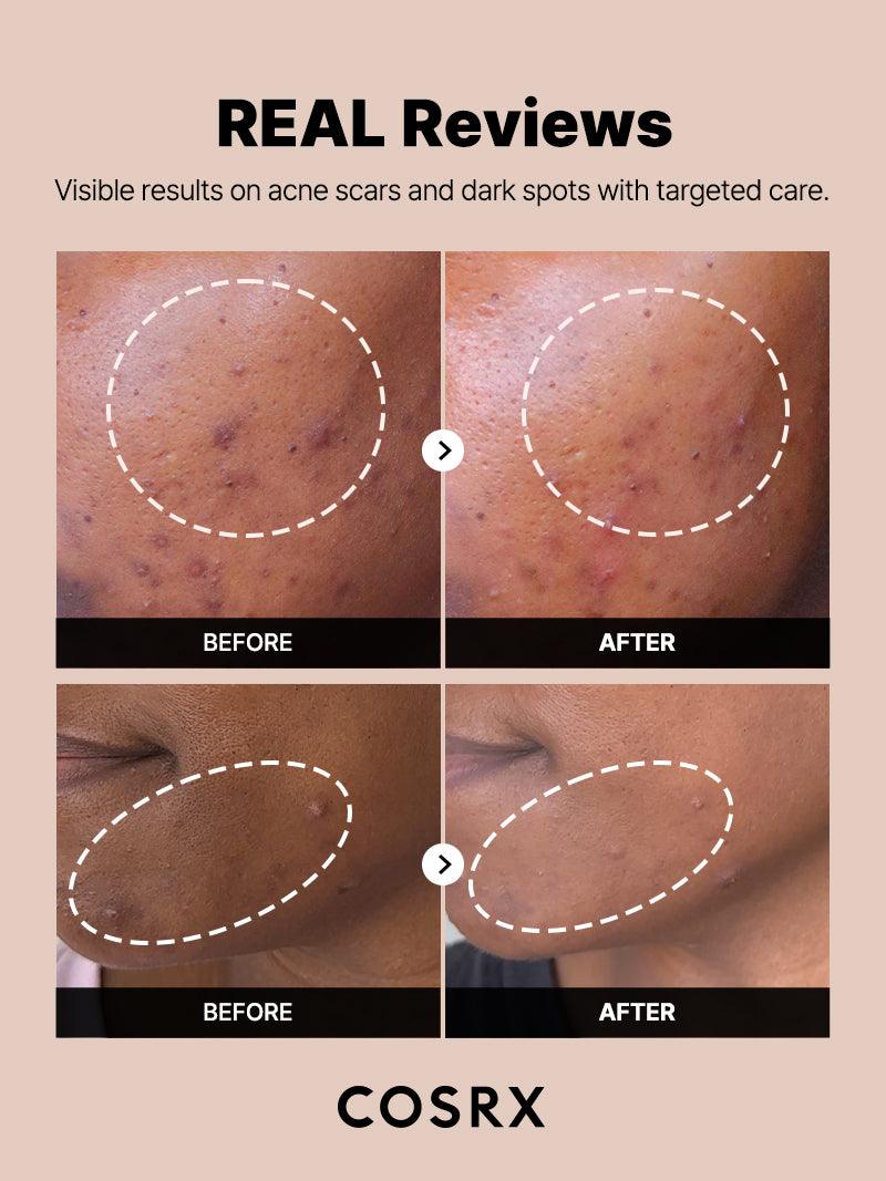 COSRX - The Alpha-Arbutin 2 Discoloration Care Serum