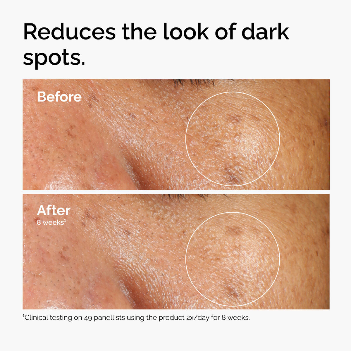 THE ORDINARY - Alpha Arbutin 2% + HA serum